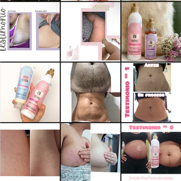 Meet your Posher, MB Distributor, LLC - Picture 7 of 17